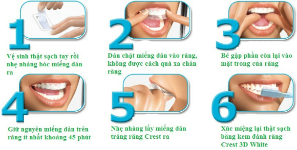 6 Bước sử dụng miếng dán trắng răng Crest - khoedeptainha.vn