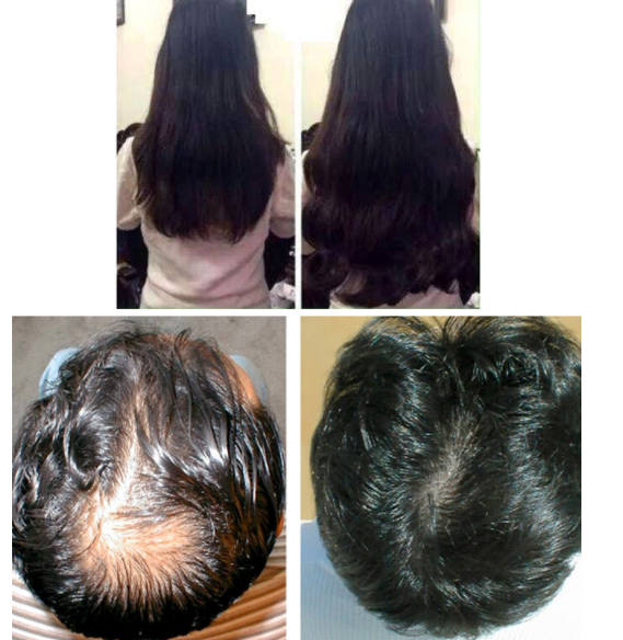 Hiệu quả sau khi dùng bộ sản phẩm kích mọc tóc Biotin và Colagen - khoedeptainha.vn