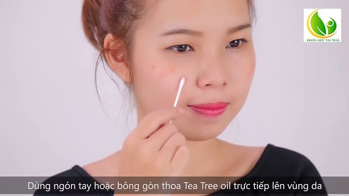  Tinh Dầu Trị Mụn Và Kháng Khuẩn The Body Shop Tea Tree Oil - Khoedeptainha.vn