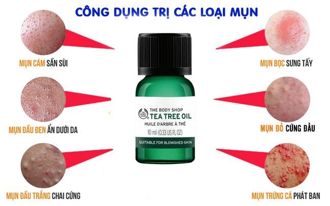 Tinh Dầu Trị Mụn Và Kháng Khuẩn The Body Shop Tea Tree Oil - Khoedeptainha.vn